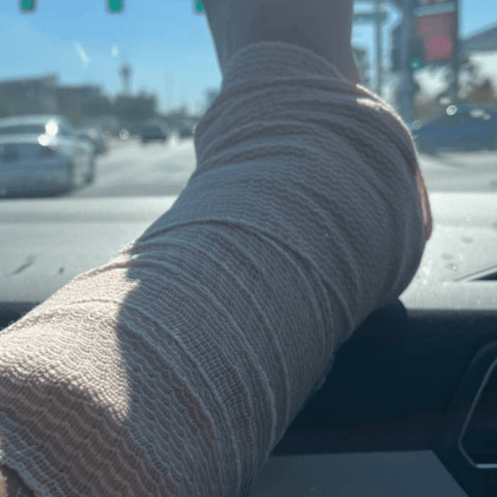 Fundraiser for Juan Muniz - Broken Heel - can you help? - Tenacious Toys®