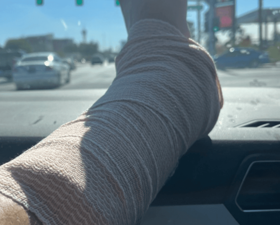 Fundraiser for Juan Muniz - Broken Heel - can you help? - Tenacious Toys®